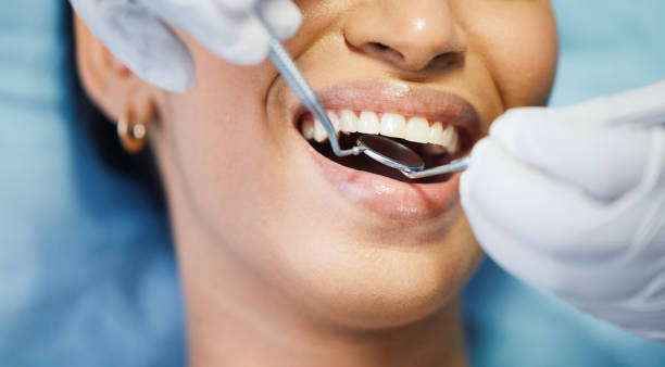 Best Walk-In Emergency Dental Services in Perry, GA