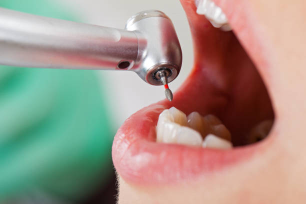 Best Emergency Dental Care for Sports Injuries in Perry, GA